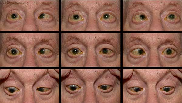 Tracking eye movement in response the various attempted gazes