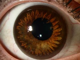 Circle Contact Lens