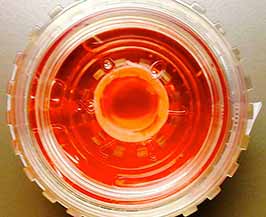 Donor cornea prepared for penetrating keratoplasty (PK) transplantation