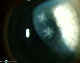 Ghost Dendrites