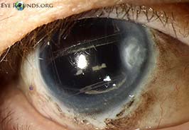 McCannel suture scaffold to reconstruct the iris plane