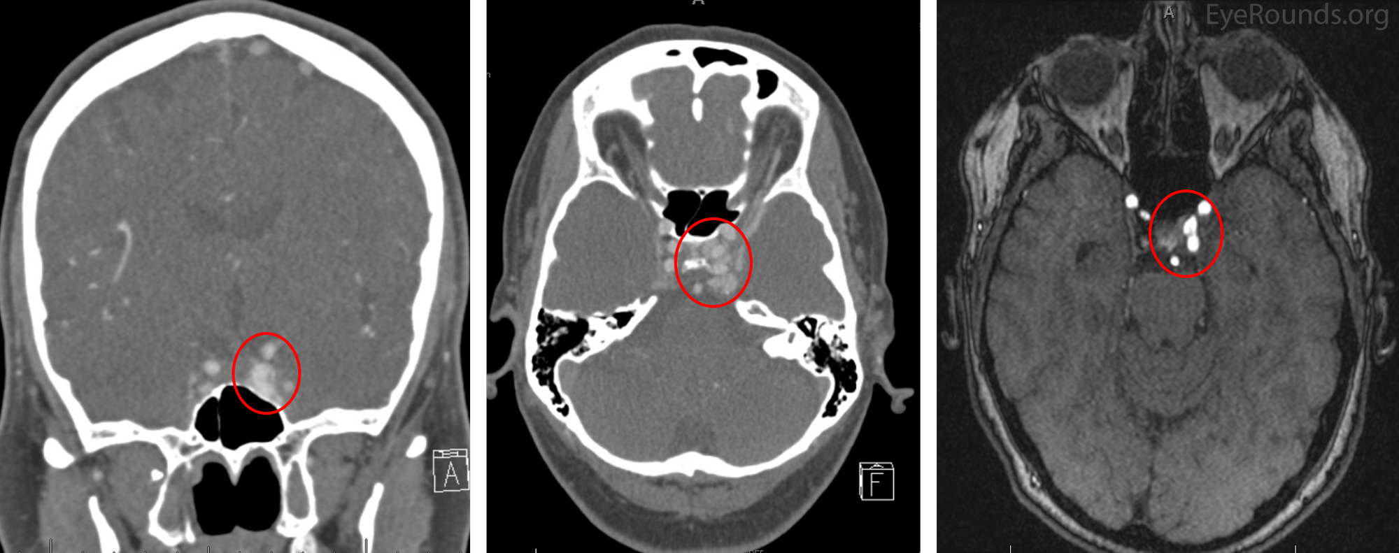 Pre-operative CT imaging