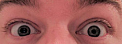 Tadpole pupil