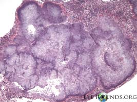 Actinomyces israelii