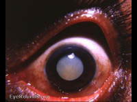 white cataract in older patients, differential diagnosis