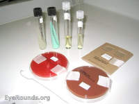 infectious keratitis