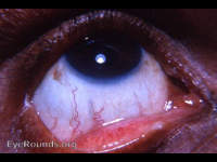 perfectly couched eye