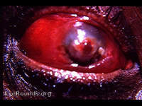 spontaneous rupture of a descemetocele with resulting panophthalmitis