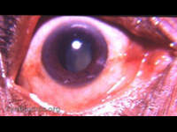 subluxated, couched lens / cataract