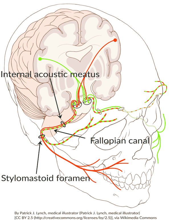 Route of the facial nerve as it enters the temporal bone through the internal acoustic meatus, travels through the Fallopian canal, and exits via the stylomastoid foramen. The Fallopian canal can be further divided into labyrinthine, tympanic, and mastoidal segments (not shown here).  Image by Patrick J. Lynch, medical illustrator [CC BY 2.5 (http://creativecommons.org/licenses/by/2.5)], via Wikimedia Commons