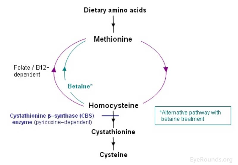 The metabolism of methionine to homocysteine and homocysteine to cysteine is shown. Specifically, the cystathionine B-synthase defect that leads to the most common form of homocystinuria is highlighted. This figure also demonstrates how betaine supplements help in homocystinuria.