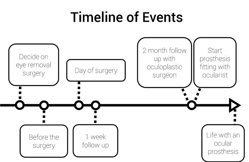 A typical timeline of events portraying what will happen before, on the day of, and after the eye removal surgery.