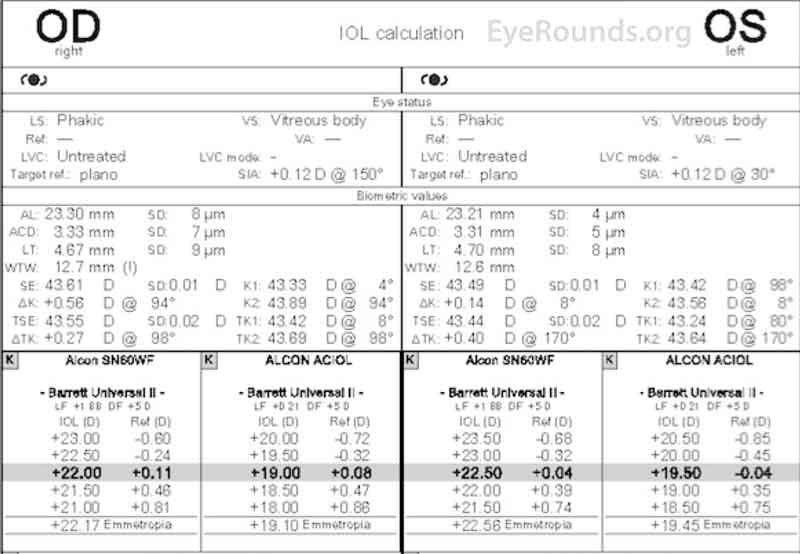 Intraocular Lens Calculations (IOL Master)