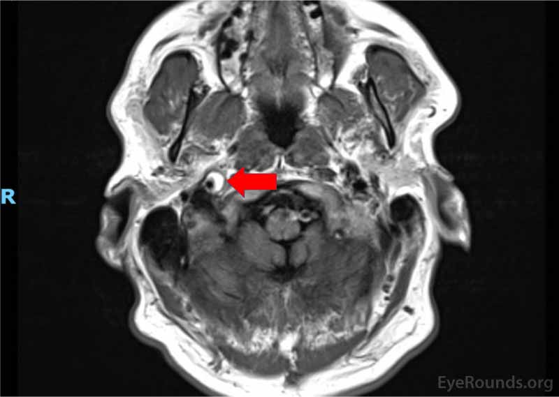  MRI/MRA head/neck/upper ches