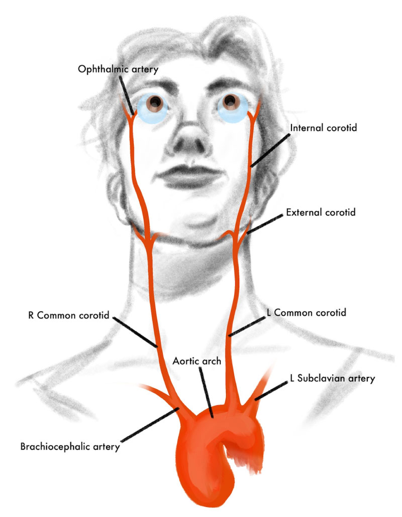 illustration shows the path of blood to the eyes which flows from the aortic arch to the common carotid arteries