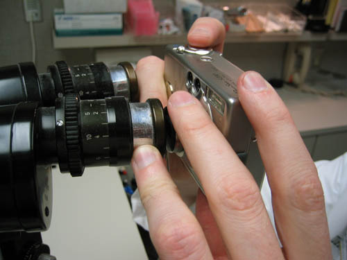 Slit lamp photography without camera adapter.