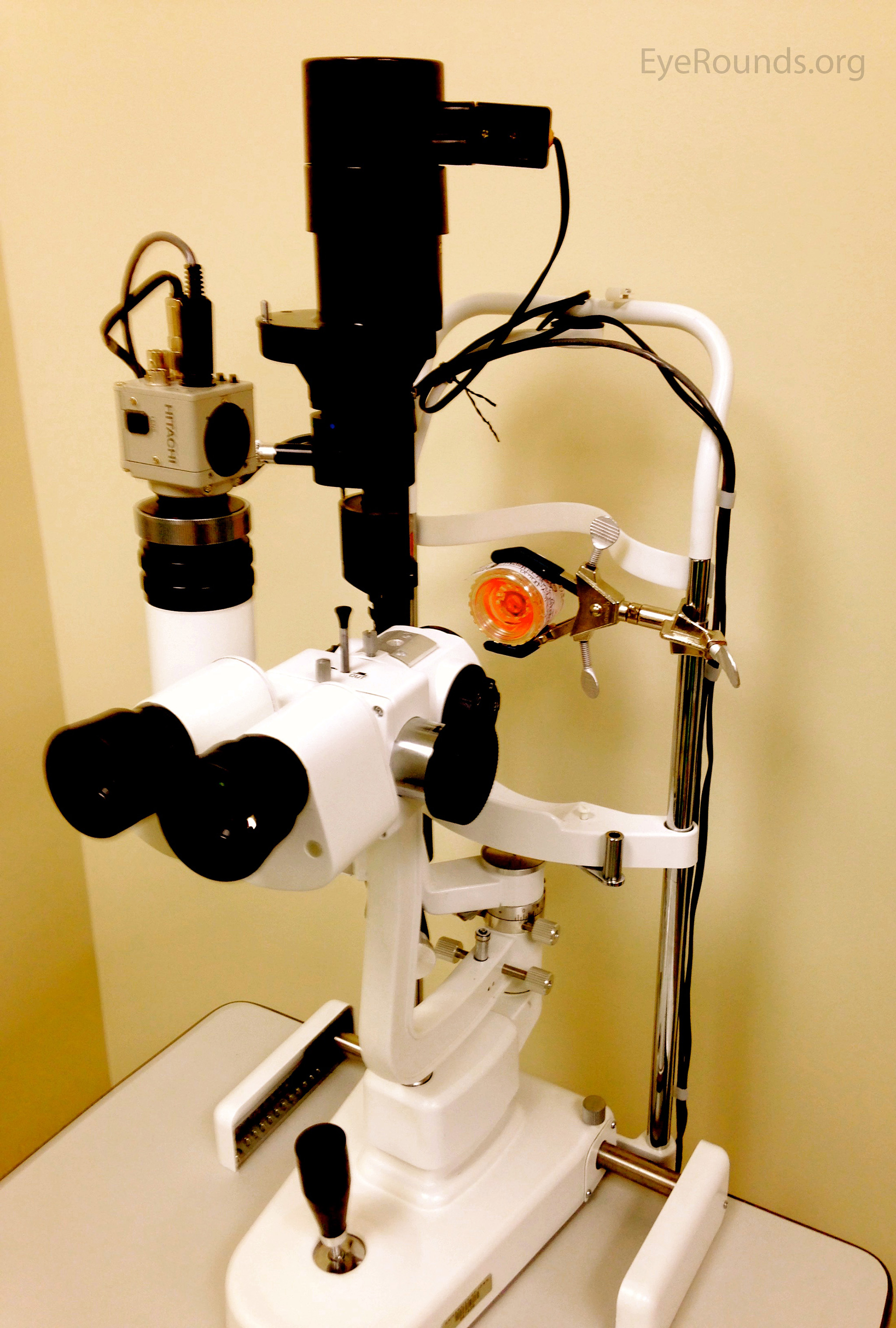 Slit lamp examination of a donor cornea 