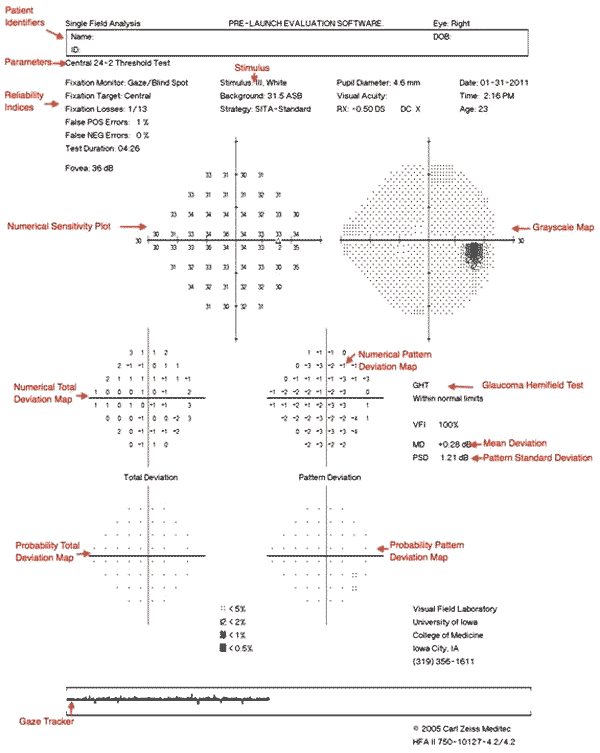 Visual Field Testing From One Medical Student To Another