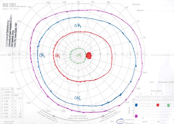 Visual Field Testing From One Medical Student To Another