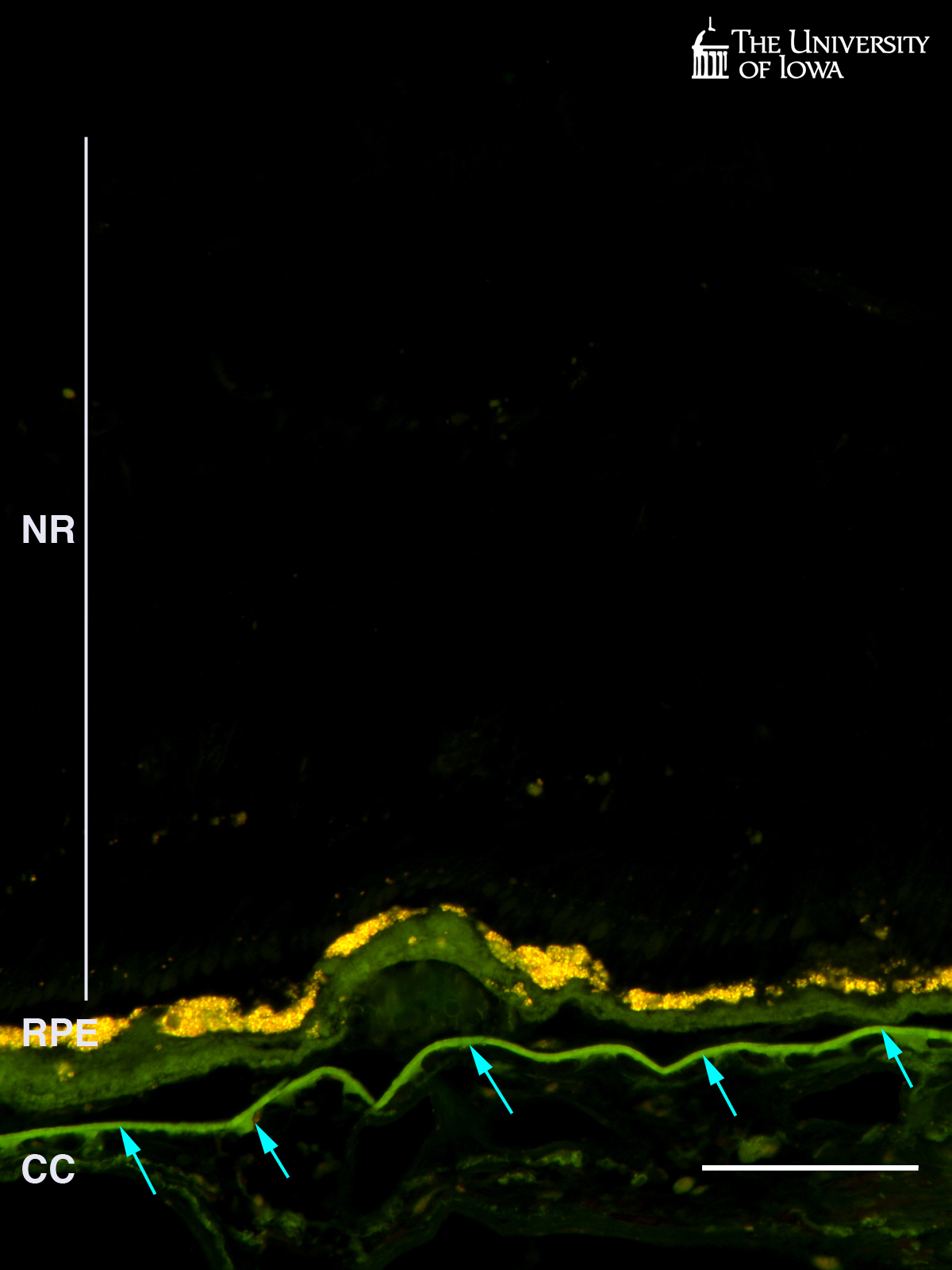 fluorescence of lipofuscin