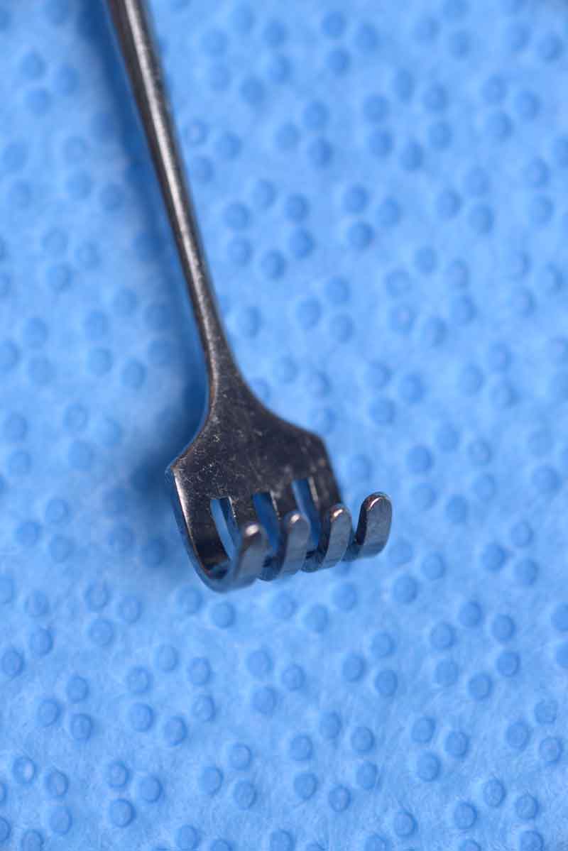 This retractor resembles a small rake with its four wide, blunt prongs. It is helpful in tight spaces such as the medial canthus/lacrimal sac. Examples of its use include when removing the medial fat pad during blepharoplasty and when performing transcaruncular dissection. 