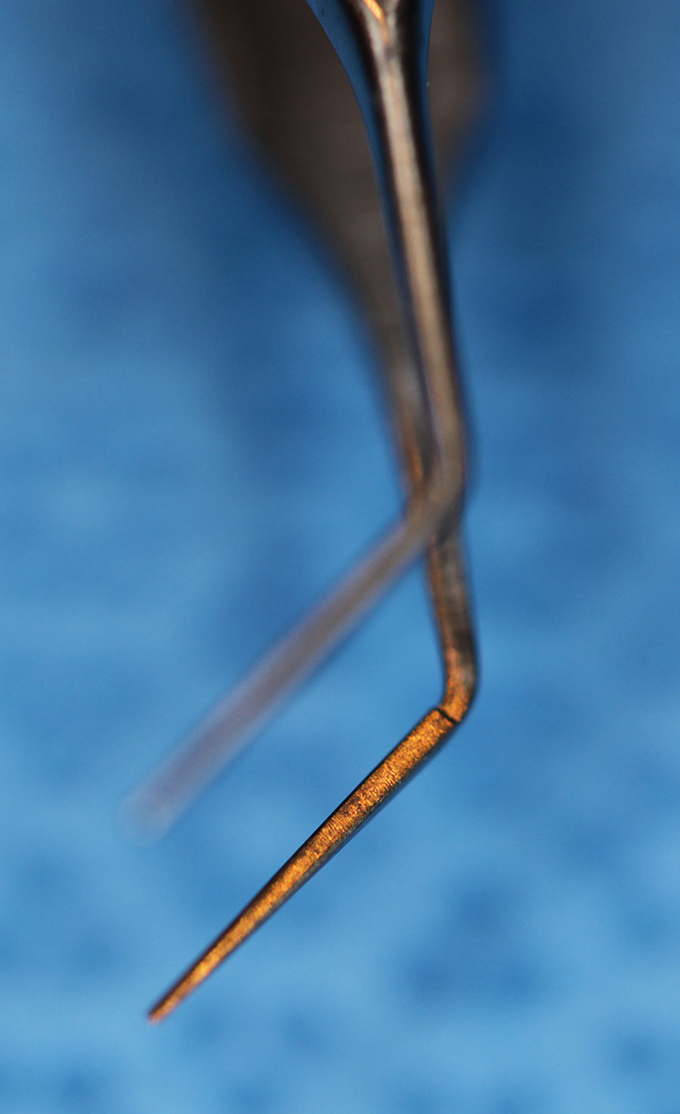 Forcep Thumb, McPherson tying iris angled