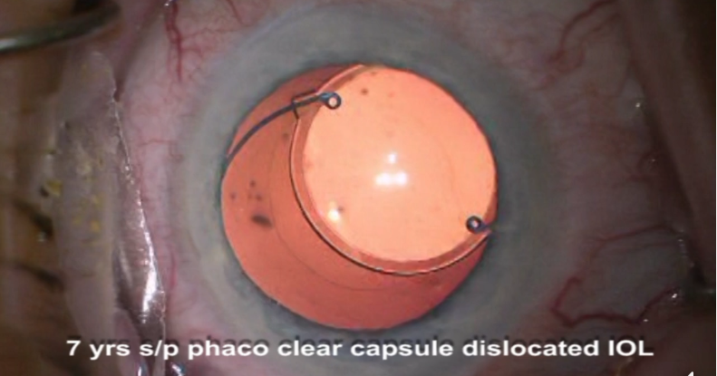 link to facebook video