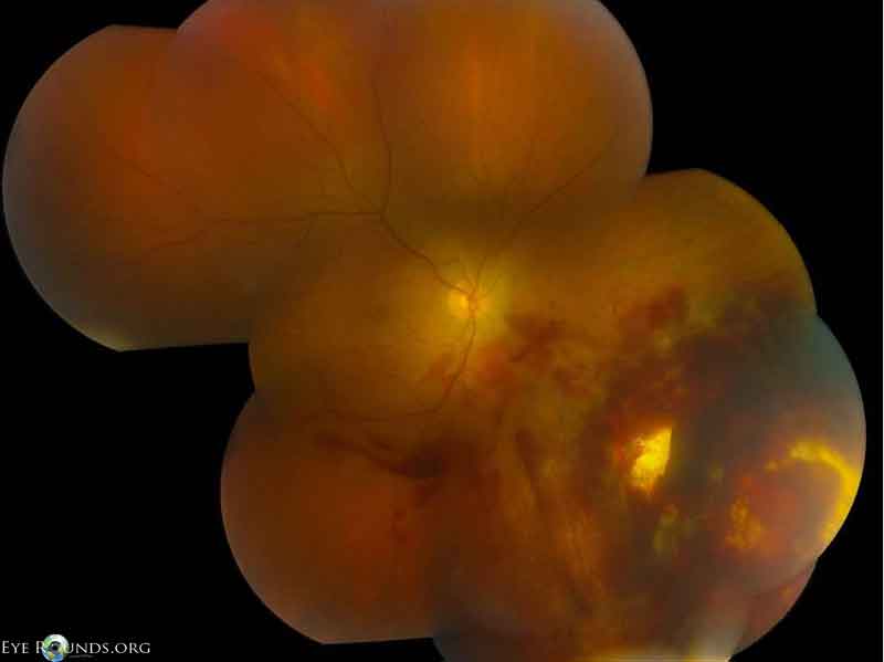 Fundus