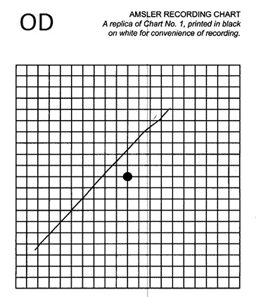 Amsler Grid