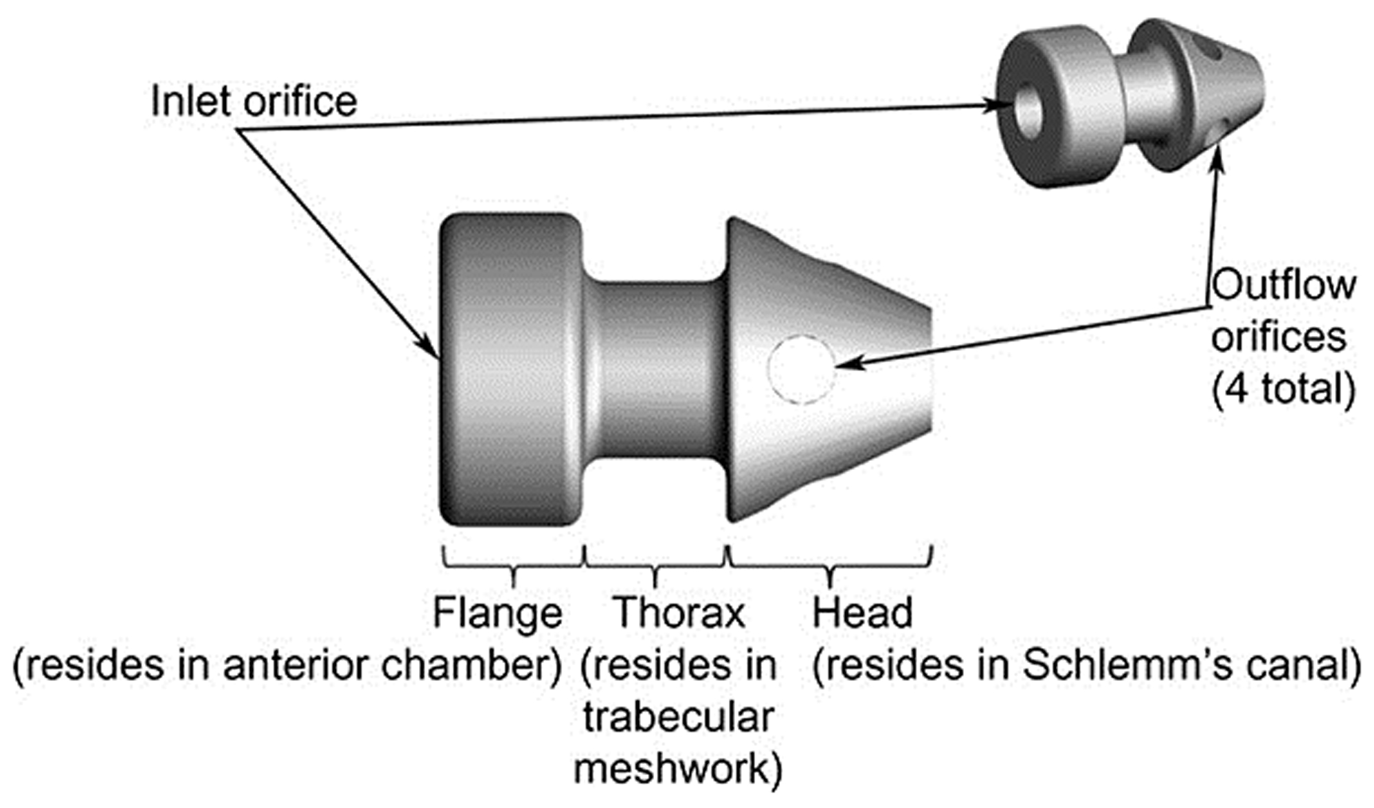 Figure 2. iStent Inject Source: Belovay et al. J Cataract Refract Surg. 2012;38(11):1911-7.[8]