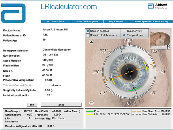 lri calculator results 