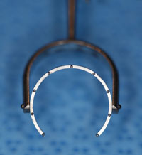Fine thornton fixation ring